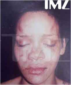 Rihanna - A szétvert Rihanna visszatért Chris Brown-hoz - durva fotóval!